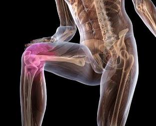 Inflamația articulației genunchiului cu artroză