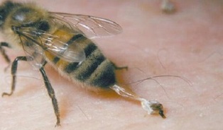 tratamentul artrozei șoldului de către albine